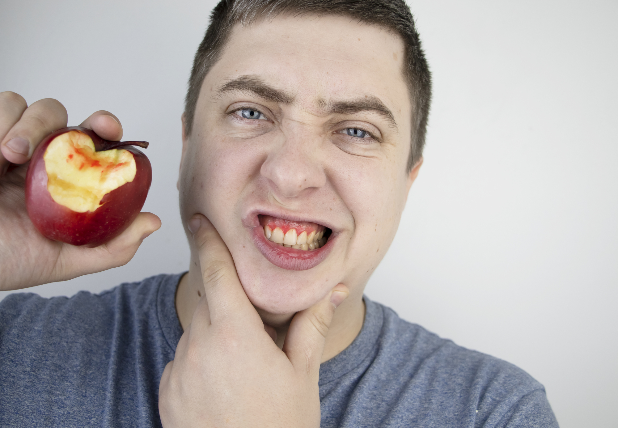 דימום חניכיים