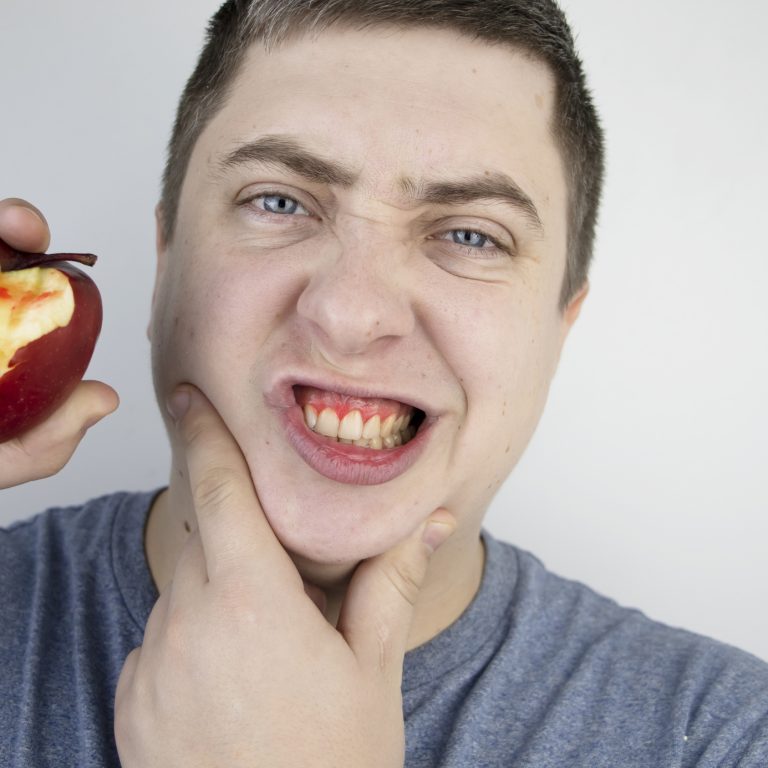 דימום חניכיים