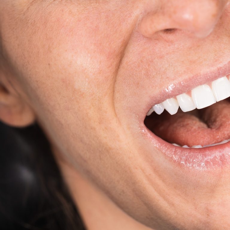 Teeth health concept. Cropped photo of smiling woman mouth under