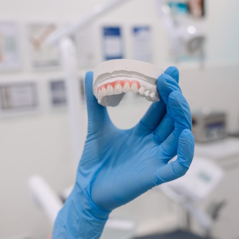 Close-up of female hand holding dental mold. High quality photo